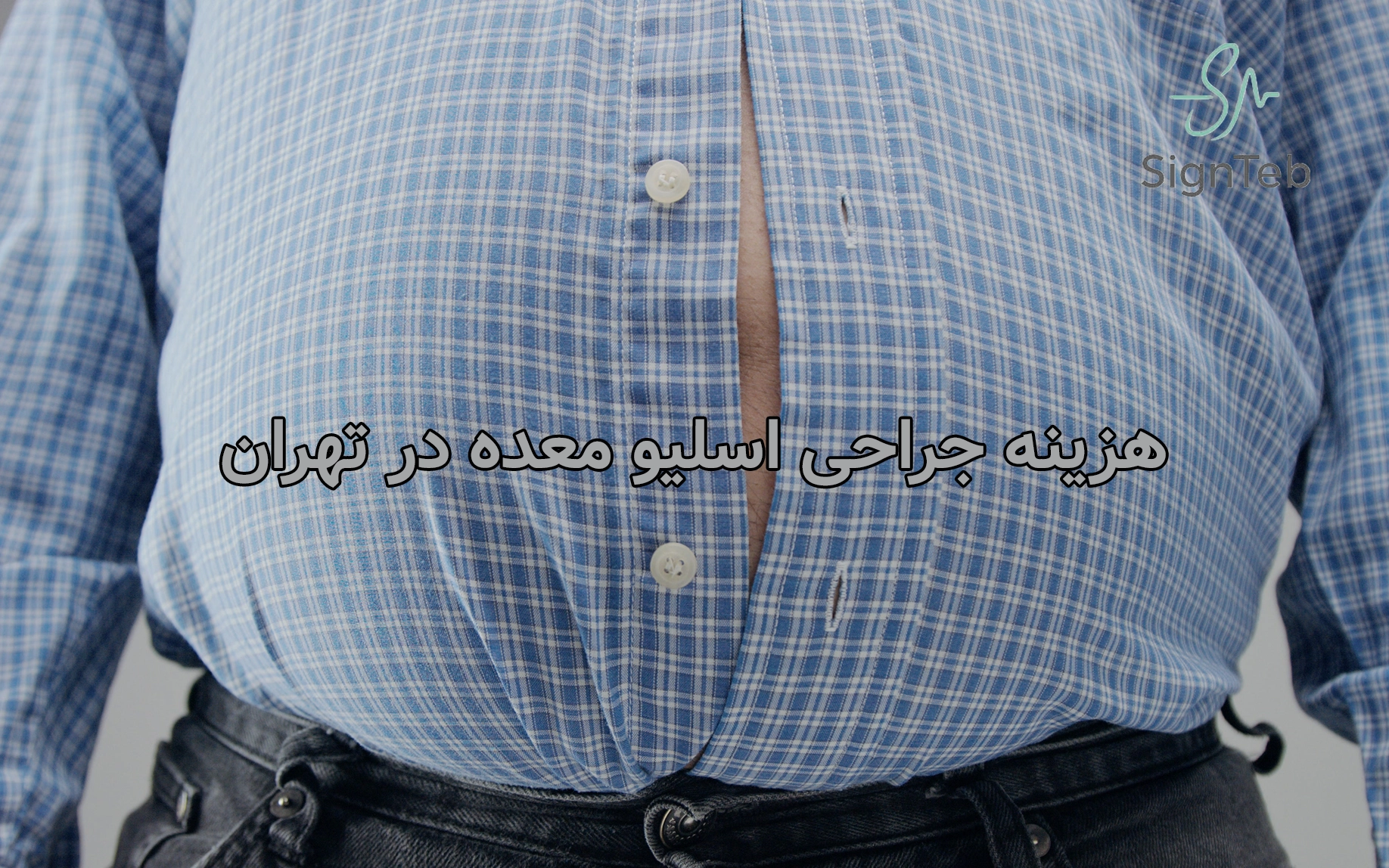 هزینه جراحی اسلیو معده در تهران